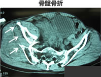 図3