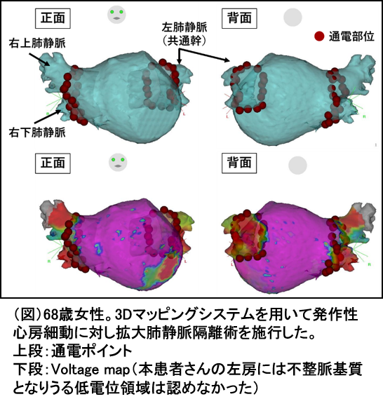 3Dマッピングシステムの図