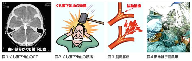 図1、図2、図3、図4